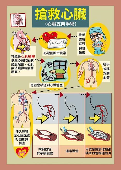 心脑血管常识(心脑血管常识知识) 第1张 心脑血管常识(心脑血管常识知识) 第1张