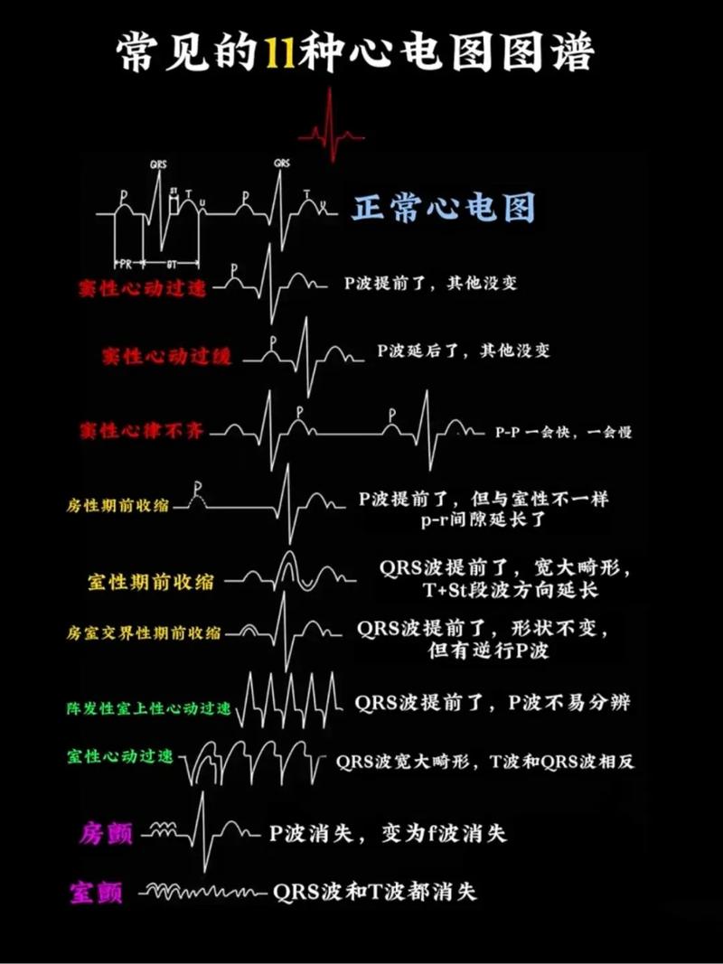 心电图基本常识 - 心电图基本常识,做一个相关PPT 第2张 心电图基本常识 - 心电图基本常识,做一个相关PPT 第2张