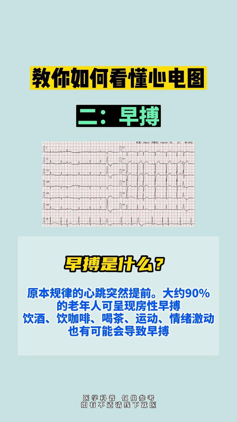 心电图基本常识 - 心电图基本常识,做一个相关PPT 第5张 心电图基本常识 - 心电图基本常识,做一个相关PPT 第5张