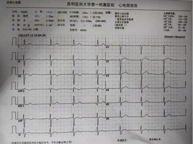 心电图基本常识 - 心电图基本常识,做一个相关PPT 第6张 心电图基本常识 - 心电图基本常识,做一个相关PPT 第6张