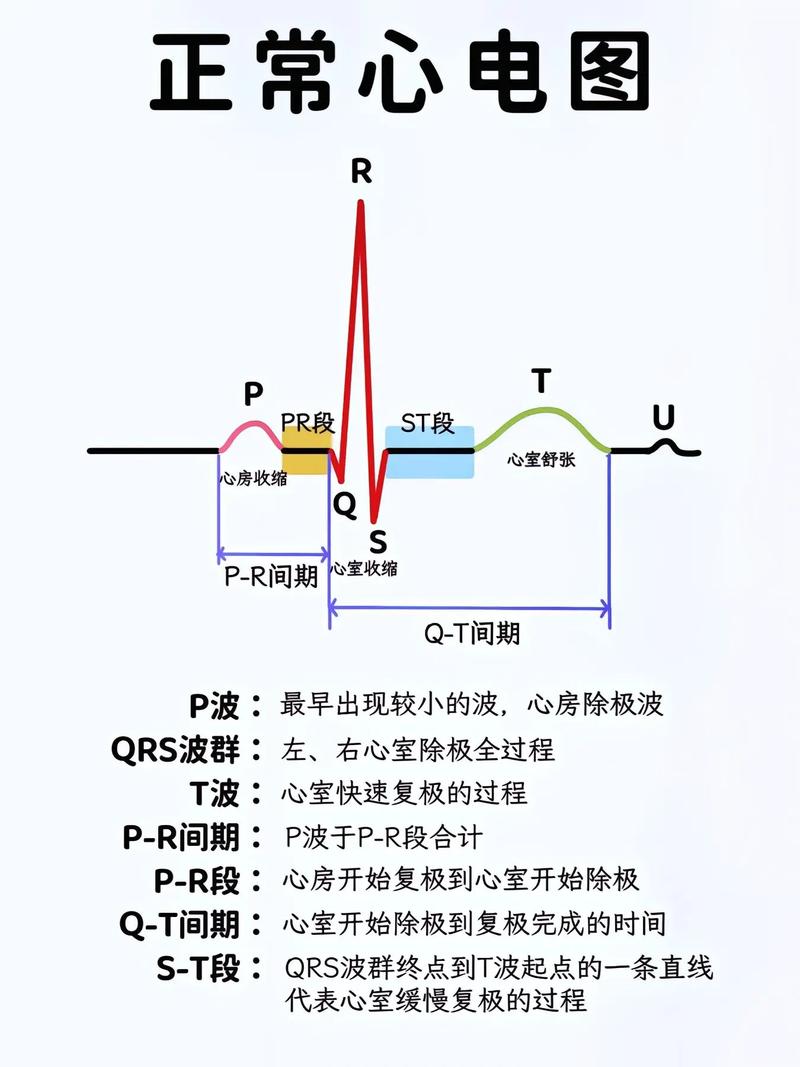 心电图基本常识 - 心电图基本常识,做一个相关PPT 第8张 心电图基本常识 - 心电图基本常识,做一个相关PPT 第8张