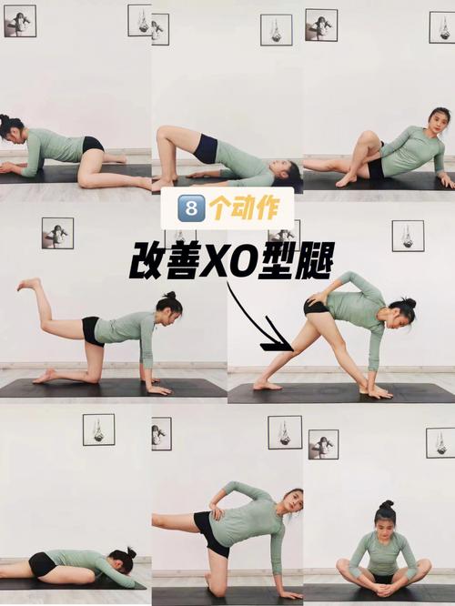 怎么矫正ox型腿小常识 - ox型腿矫正器矫正有效吗 第4张 怎么矫正ox型腿小常识 - ox型腿矫正器矫正有效吗 第4张
