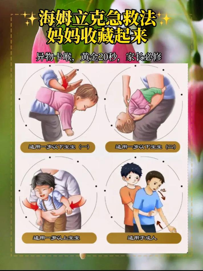 宝宝卡住急救常识(宝宝卡住急救常识大全) 第3张 宝宝卡住急救常识(宝宝卡住急救常识大全) 第3张