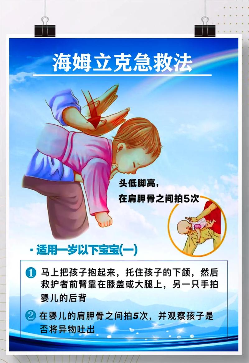 宝宝卡住急救常识(宝宝卡住急救常识大全) 第4张 宝宝卡住急救常识(宝宝卡住急救常识大全) 第4张