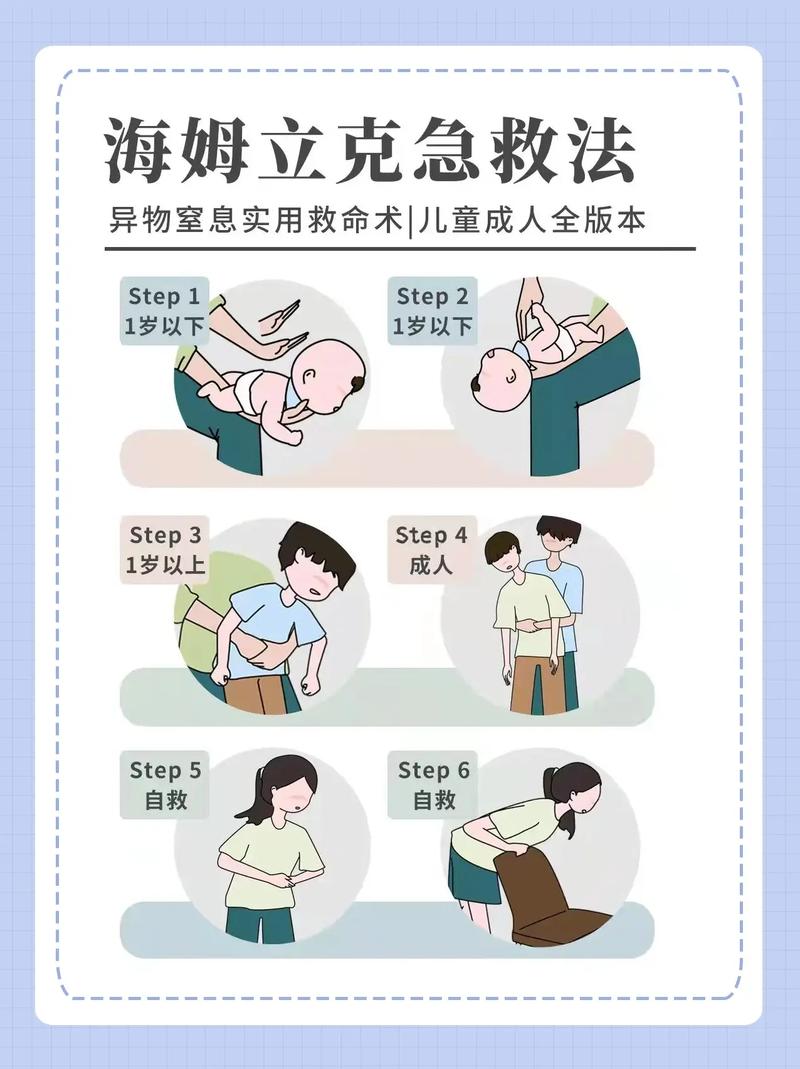 宝宝卡住急救常识(宝宝卡住急救常识大全) 第5张 宝宝卡住急救常识(宝宝卡住急救常识大全) 第5张