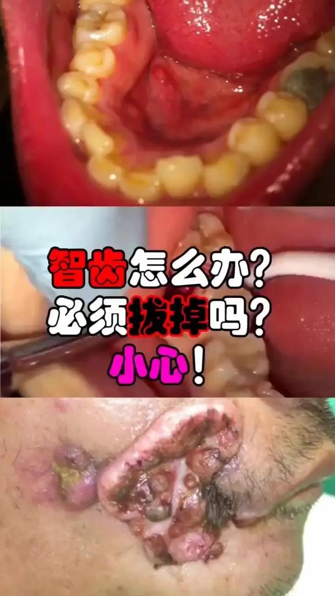 这个牙不取出行吗(牙齿可以不拔就装新牙?) 第5张 这个牙不取出行吗(牙齿可以不拔就装新牙?) 第5张