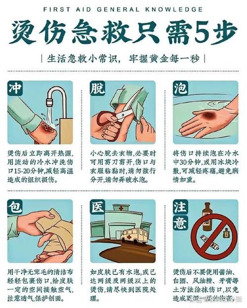烧伤急救常识有哪些呢(烧伤急救小知识) 第5张 烧伤急救常识有哪些呢(烧伤急救小知识) 第5张