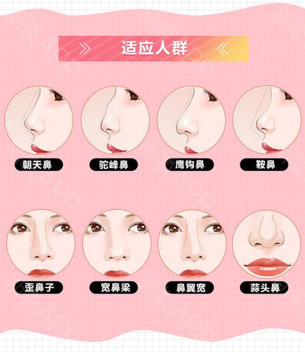 鼻部整形常识(鼻部整形的常识) 第2张 鼻部整形常识(鼻部整形的常识) 第2张