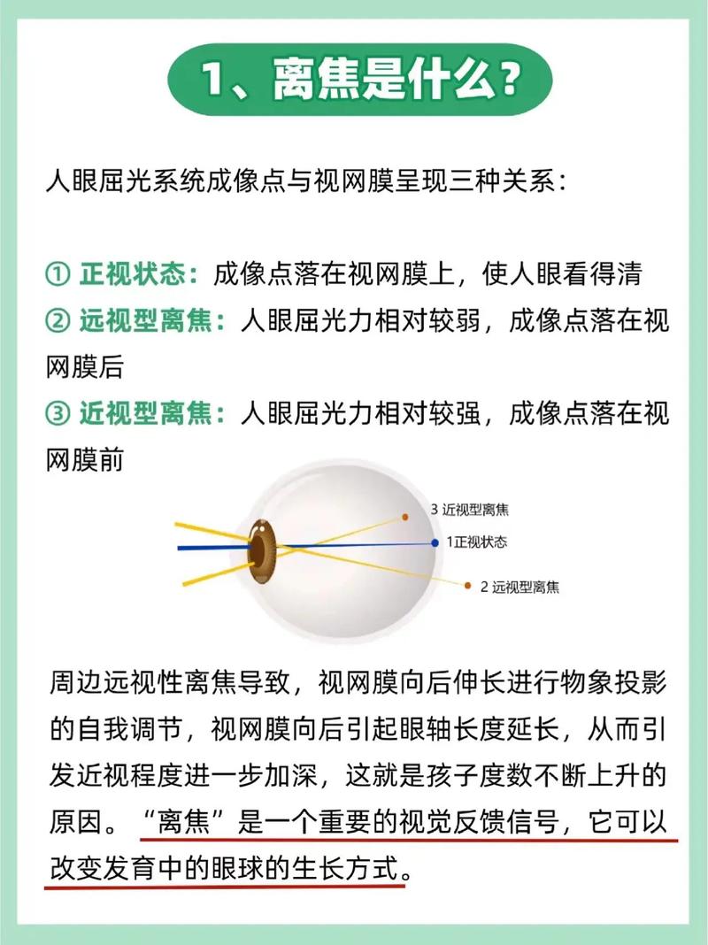 开眼镜店的基本常识,开眼镜店必备的条件 第1张 开眼镜店的基本常识,开眼镜店必备的条件 第1张