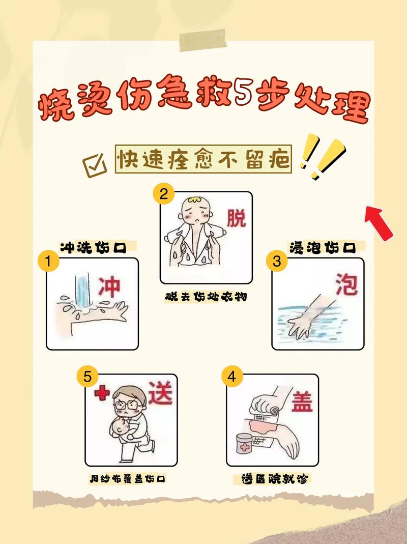 沸水烫伤自救常识 - 沸水烫伤自救常识视频 第5张 沸水烫伤自救常识 - 沸水烫伤自救常识视频 第5张
