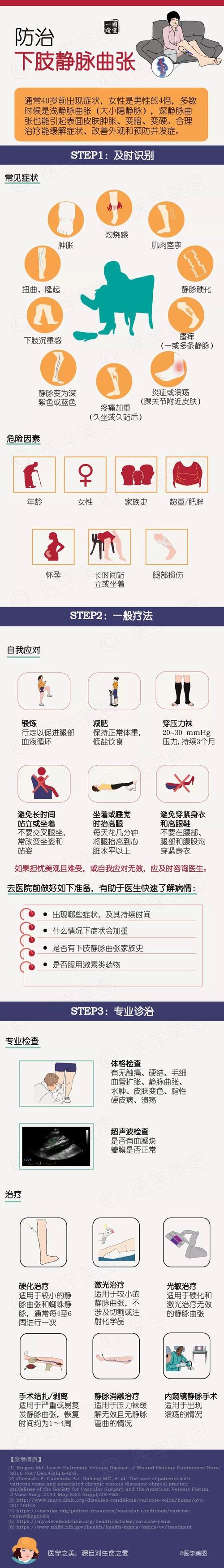静脉曲张常识(静脉曲张的相关知识) 第7张 静脉曲张常识(静脉曲张的相关知识) 第7张