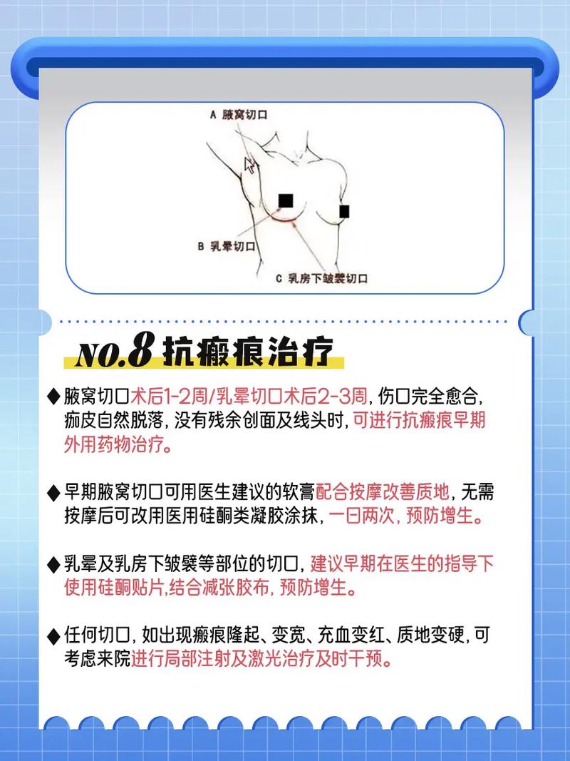 假体隆胸常识,假体隆胸经验分享 第3张 假体隆胸常识,假体隆胸经验分享 第3张