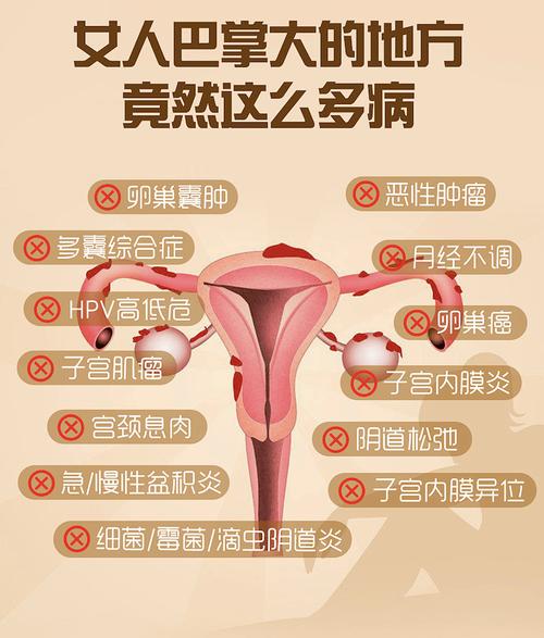 妇科常识大全 - 妇科小常识100条简短 第4张 妇科常识大全 - 妇科小常识100条简短 第4张