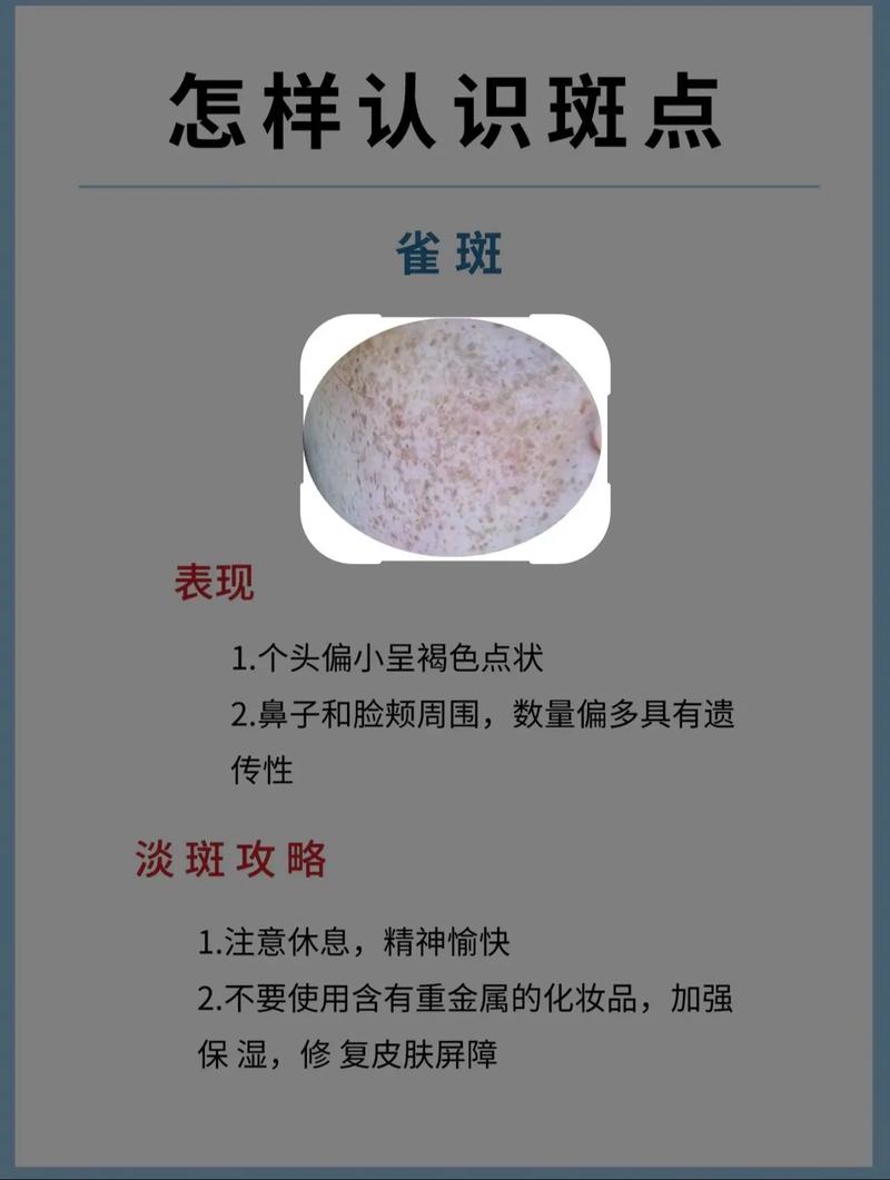 生活祛斑小常识(生活祛斑小常识大全) 第3张 生活祛斑小常识(生活祛斑小常识大全) 第3张