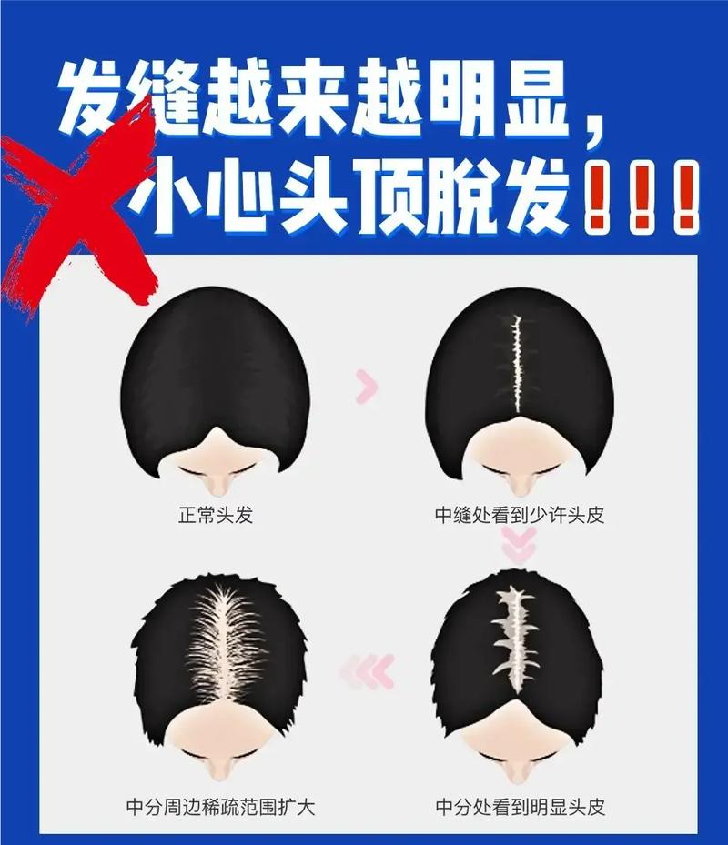 养发护发常识 - 养发知识100条 第7张 养发护发常识 - 养发知识100条 第7张