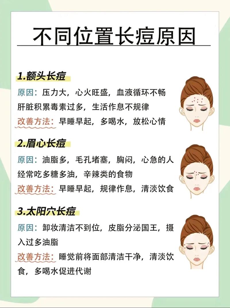 去痘痘小常识(去痘痘小妙方) 第1张 去痘痘小常识(去痘痘小妙方) 第1张