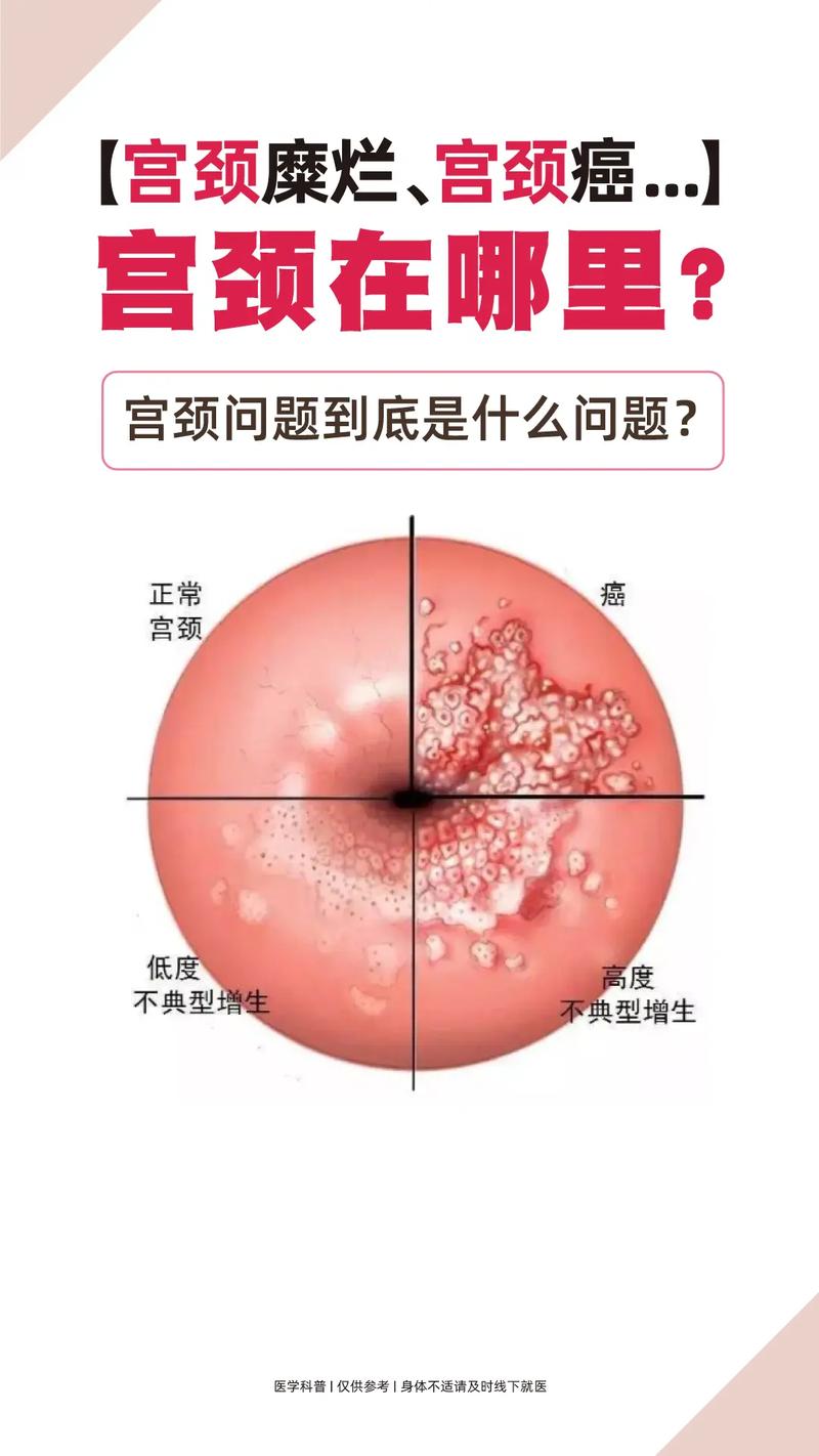 男生必懂的女性生理常识,男生必懂的女性生理常识大全 第3张 男生必懂的女性生理常识,男生必懂的女性生理常识大全 第3张
