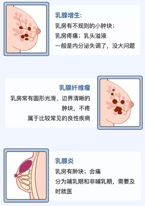 内衣健康小常识大全(内衣知识小课堂) 第2张 内衣健康小常识大全(内衣知识小课堂) 第2张