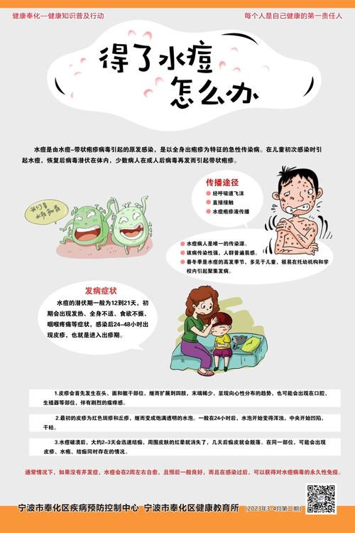 预防水痘小常识,预防水痘小常识10条 第4张 预防水痘小常识,预防水痘小常识10条 第4张