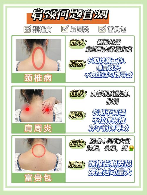 颈椎病小常识(颈椎病需有哪些技巧) 第1张 颈椎病小常识(颈椎病需有哪些技巧) 第1张
