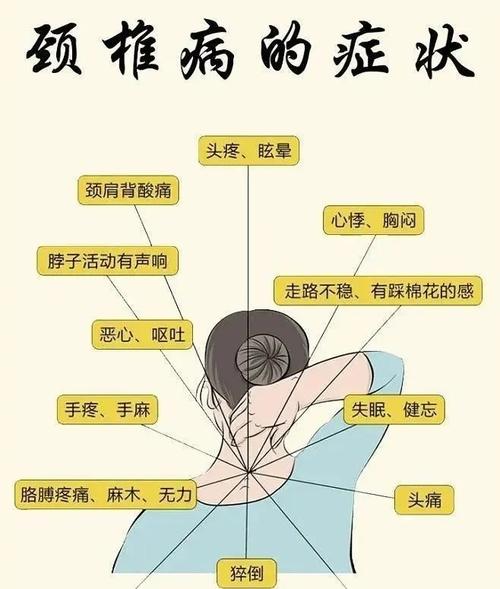 颈椎病小常识(颈椎病需有哪些技巧) 第6张 颈椎病小常识(颈椎病需有哪些技巧) 第6张