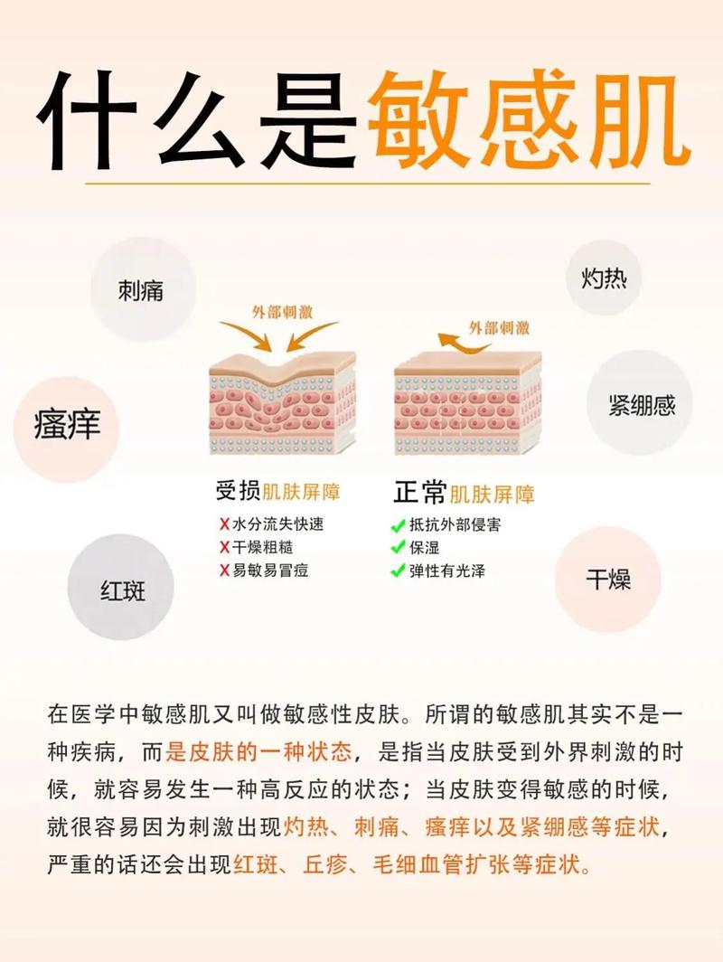 修复敏感肌肤的小常识的简单介绍 第4张 修复敏感肌肤的小常识的简单介绍 第4张