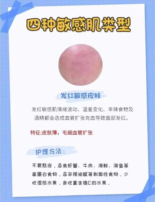 修复敏感肌肤的小常识的简单介绍 第7张 修复敏感肌肤的小常识的简单介绍 第7张