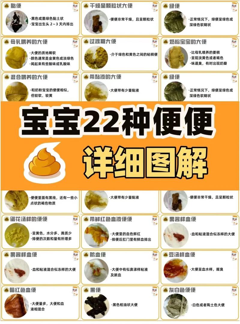 婴儿大便颜色常识(图解),婴儿大便颜色常识图解 对照表 第4张 婴儿大便颜色常识(图解),婴儿大便颜色常识图解 对照表 第4张