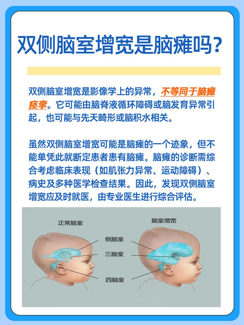 双侧侧脑室的常识讲述(双侧侧脑室的常识讲述错误的是) 第4张 双侧侧脑室的常识讲述(双侧侧脑室的常识讲述错误的是) 第4张