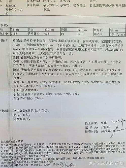 双侧侧脑室的常识讲述(双侧侧脑室的常识讲述错误的是) 第5张 双侧侧脑室的常识讲述(双侧侧脑室的常识讲述错误的是) 第5张