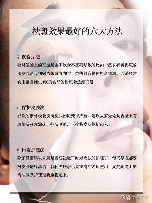 生活常识怎么样能祛斑,生活祛斑小妙招大全教你日常生活中怎样去 第4张 生活常识怎么样能祛斑,生活祛斑小妙招大全教你日常生活中怎样去 第4张