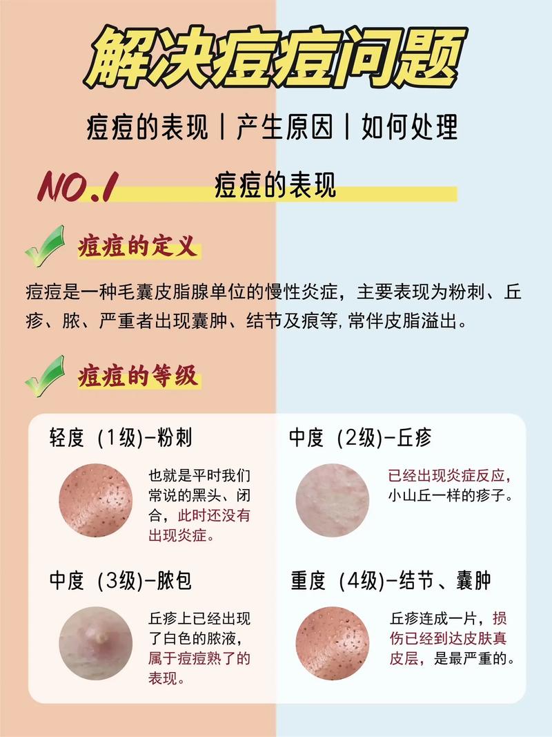 护肤小常识1000条 - 美容护肤小知识 第5张 护肤小常识1000条 - 美容护肤小知识 第5张