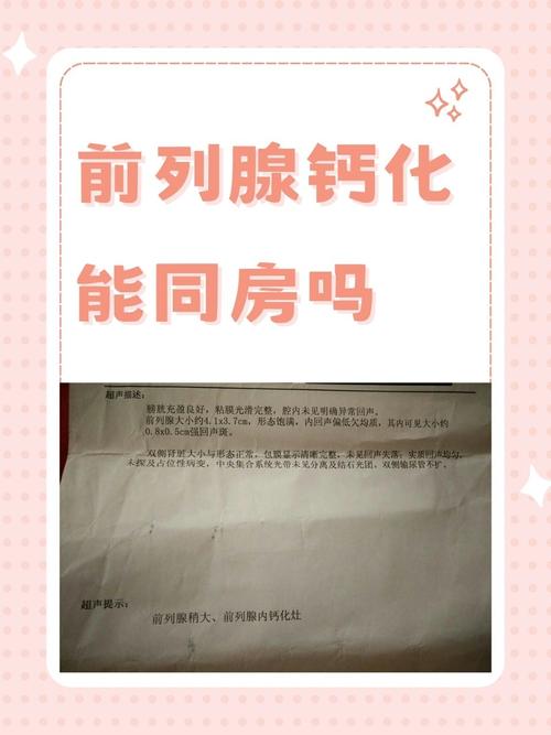 男性卫生常识,男性卫生健康常识 第8张 男性卫生常识,男性卫生健康常识 第8张