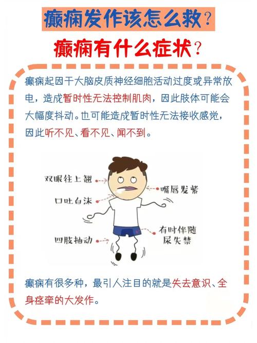癫痫病的治疗常识有哪些的简单介绍 第3张 癫痫病的治疗常识有哪些的简单介绍 第3张