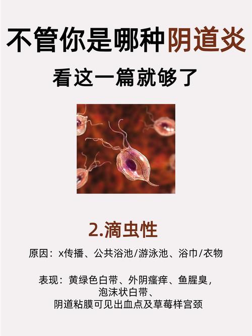 妇科检查常识,妇科检查的常规项目 第1张 妇科检查常识,妇科检查的常规项目 第1张