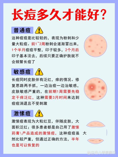 祛痘生活小常识,祛痘日常应该注意什么 第6张 祛痘生活小常识,祛痘日常应该注意什么 第6张