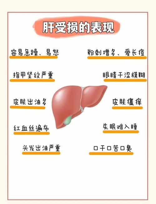 肝病自测常识,肝病自我检查 第4张 肝病自测常识,肝病自我检查 第4张