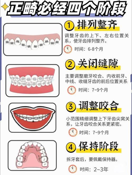 牙齿正畸常识 - 牙齿正畸的利与弊 第5张 牙齿正畸常识 - 牙齿正畸的利与弊 第5张