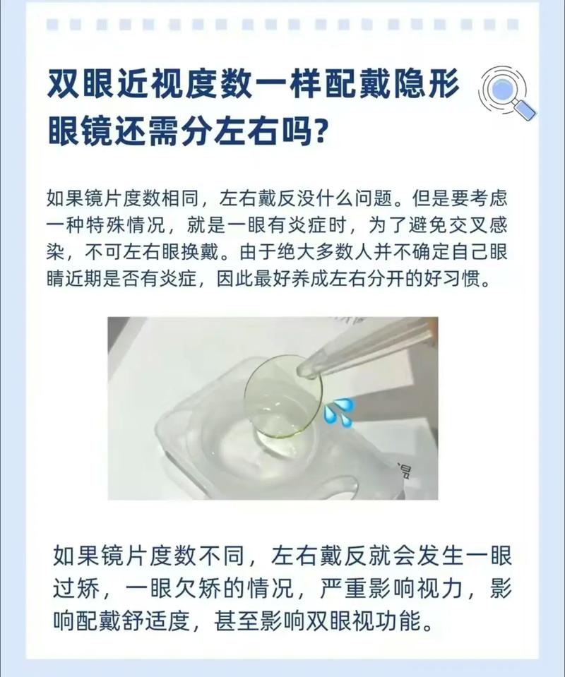 初次带隐形眼镜必知常识,初次带隐形眼镜必知常识有哪些 第5张 初次带隐形眼镜必知常识,初次带隐形眼镜必知常识有哪些 第5张