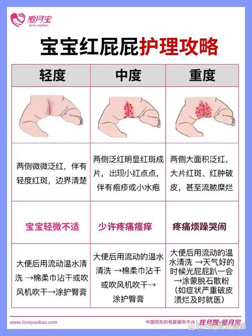 新生儿屁屁护理常识(新生儿屁屁怎样护理) 第5张 新生儿屁屁护理常识(新生儿屁屁怎样护理) 第5张